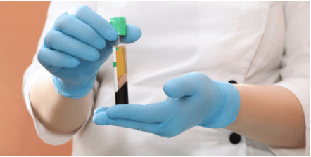 Platelet Rich Plasma (PRP) Therapy